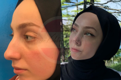 Nuran kalekoğlu web - 11
